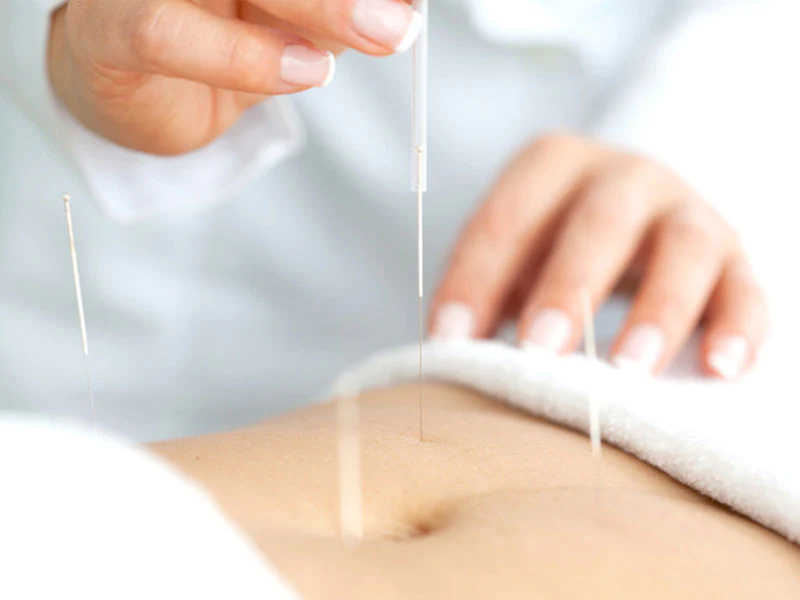 Acupuncture and Fertility: What You Need to Know