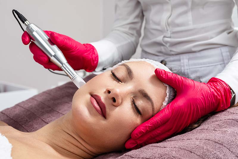 Microneedling Facial