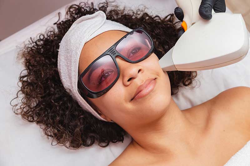 Permanent Hair Reduction