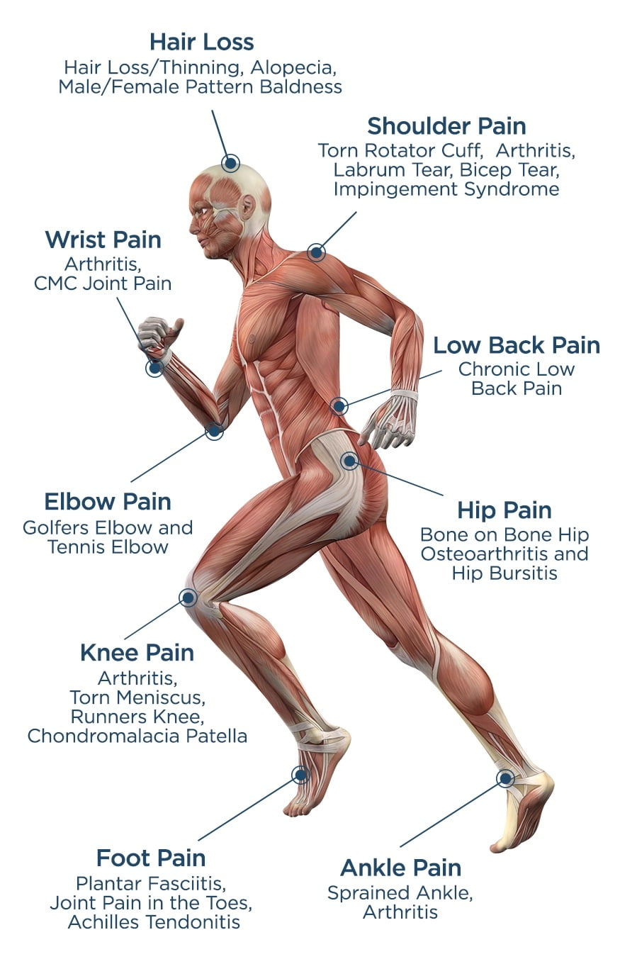regenerative medicine treatment body diagram illustration